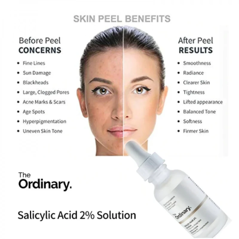 the-ordinary-niacinamide-10-zinc-1-makeup-stash-pakistan-2934329